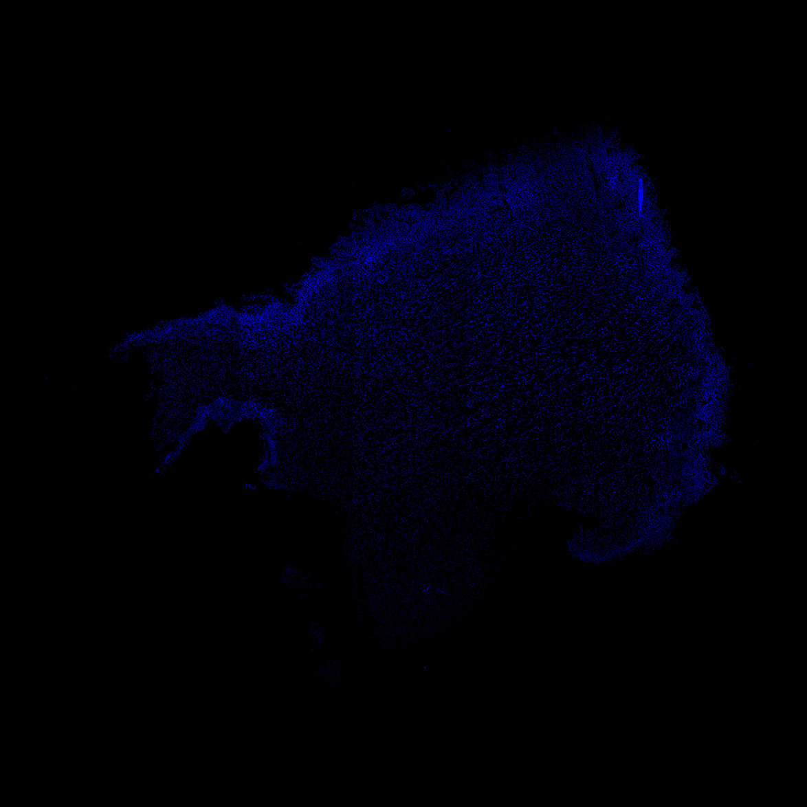 Human foetal midbrain